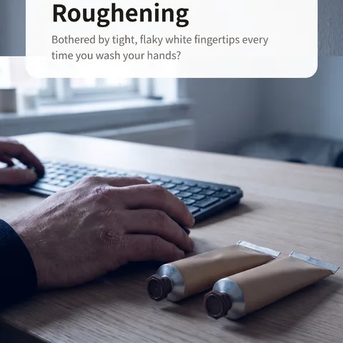Hands Keep Cracking and Roughening